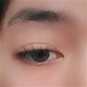 Kết
