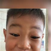 Bản