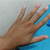 Onl