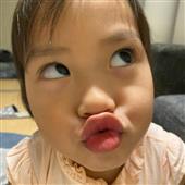 Kết